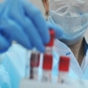 Koronavirus infeksiyasi aniqlangan bemorlarning ahvoli to‘g‘risida ma’lumot berildi