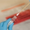 O‘zbekistonda koronavirus yuqtirganlar soni oshdi