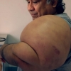 G‘avvos suv sirtiga keskin ko‘tarilgach 30 kilogrammga og‘irlashib ketdi