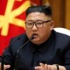 Kim Chen Inda o‘tkazilgan jarrohlik amaliyoti tafsilotlari paydo bo‘ldi