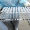O‘zbekistonda koronavirus diagnostika vositalari va dori-darmoni uchun katta pul mukofoti ajratildi