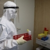 Olimlar epidemiyalar uchun insoniyat tomonidan “ideal sharoitlar” yaratilganidan ogohlantirishdi