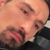 Dima Bilan oyog‘ini ikki joyidan sindirib oldi