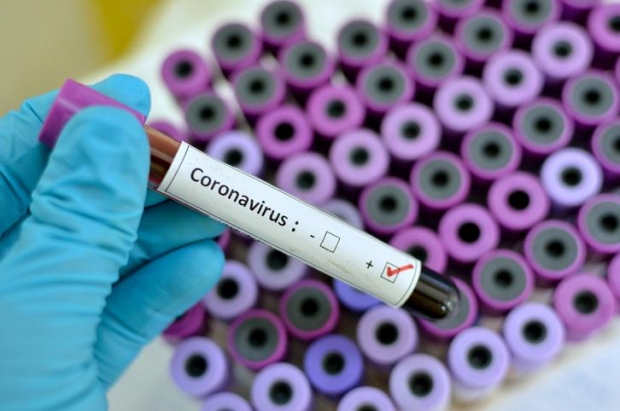 Koronavirus qanday haroratda tarqalmasligi ma’lum qilindi