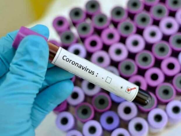 Koronavirus aniqlangan eng so‘nggi bemor haqida ma’lumot berildi