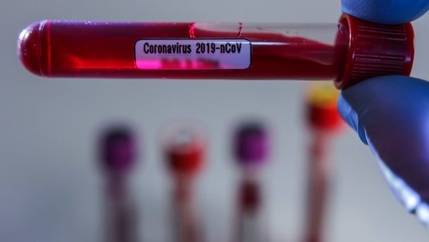 Koronavirus terrorizmga tenglashtirildimi?