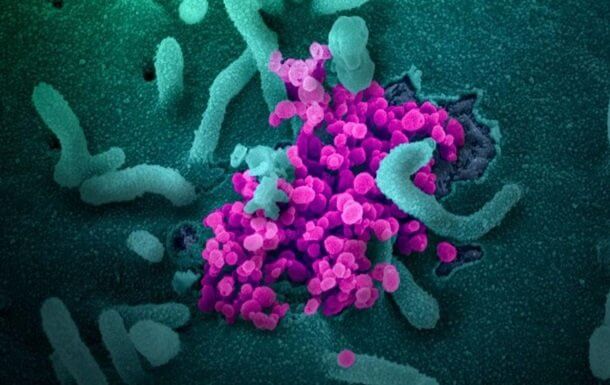 Koronavirus hujumi mikroskop ostida (Fotogalereya)
