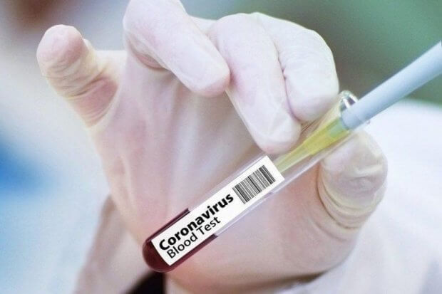 Qozog‘istonda koronavirus yuqtirganlar soni 961 nafarga yetdi