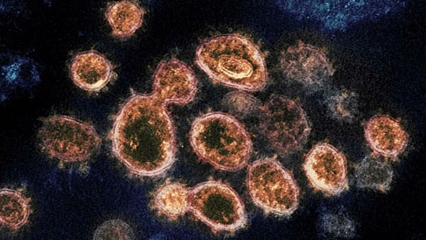 Koronavirus inson immunitetining asosiy hujayralaridan biriga zarar yetkazishi aniqlandi