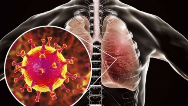 Koronavirus: qaysi viloyatlarda infeksiya ko‘p tarqalgani ma’lum bo‘ldi