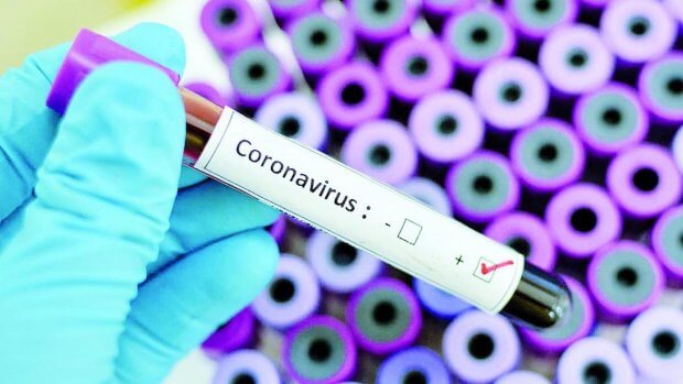 O‘zbekistonda koronavirusdan zararlanish holatlari soni 2231taga yetdi
