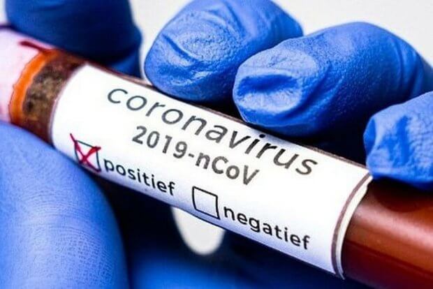 O‘zbekistonda koronavirusdan zararlanish holatlari soni 2741taga yetdi