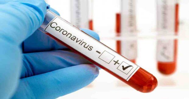 O‘zbekistonda koronavirusdan sog‘ayganlar soni 11 kishiga ko‘payib, 2349 nafarga yetdi