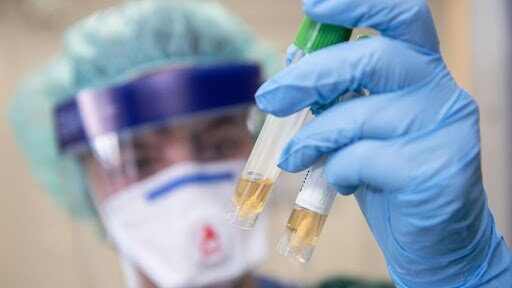 Toshkent shahrida aholi orasidan yana 7 kishida koronavirus aniqlandi