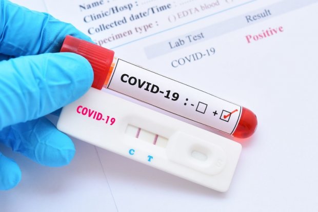 O‘zbekistonda koronavirus qayd etilganlar soni 39 641 nafarga yetdi