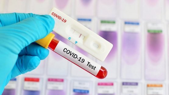 Koronavirus testini soxtalashtirayotgan guruh fosh etildi