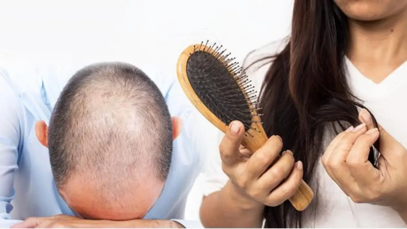 What is seasonal hair loss?