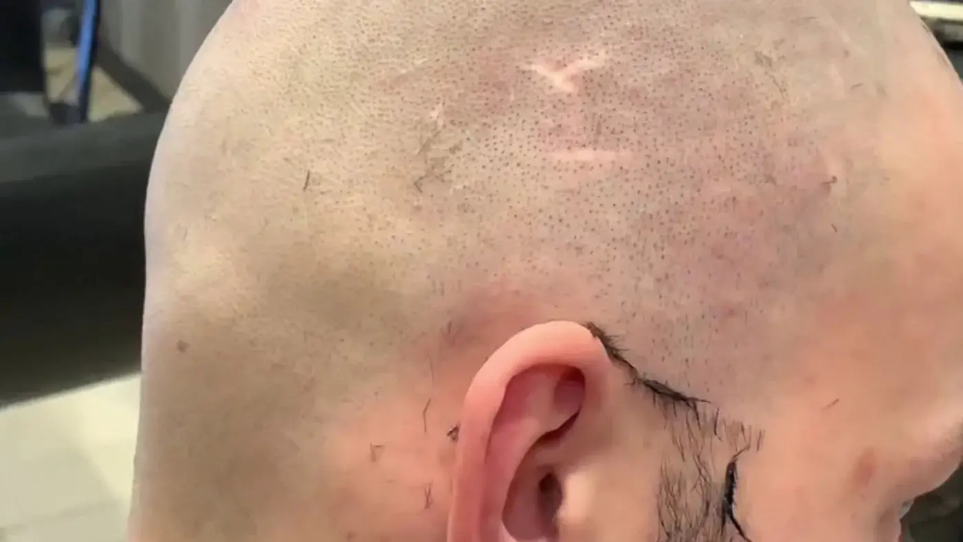 Student forcibly shaved bald in Tashkent private school