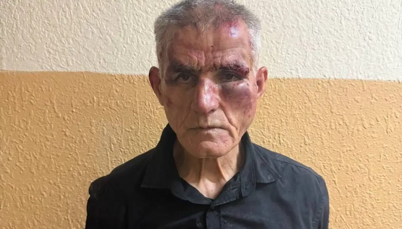 Юнусобод бозорида ички ишлар ходими пичоқланди