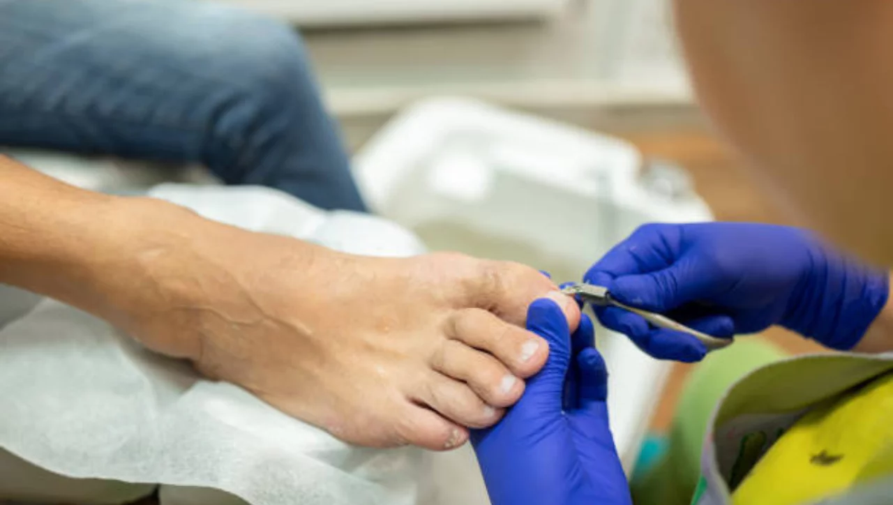 How to prevent ingrown toenails?
