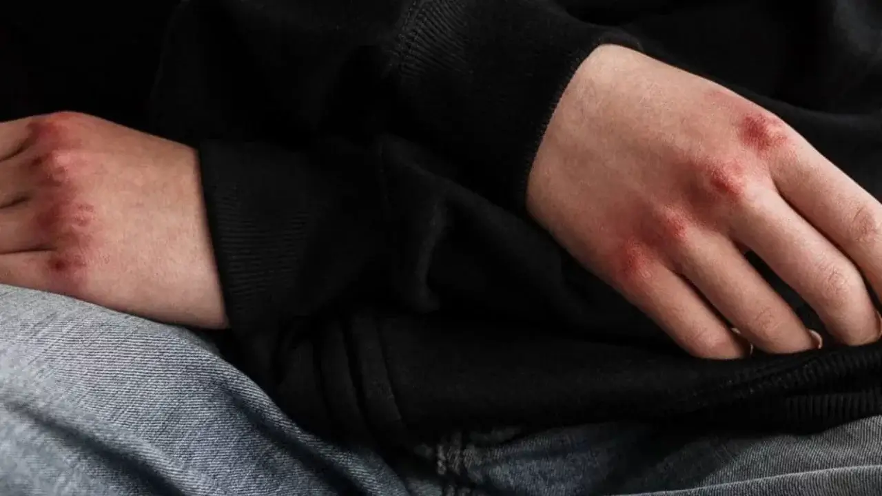 İki kız kardeş aynı adamla evlendi ve farklı koşullar altında öldü