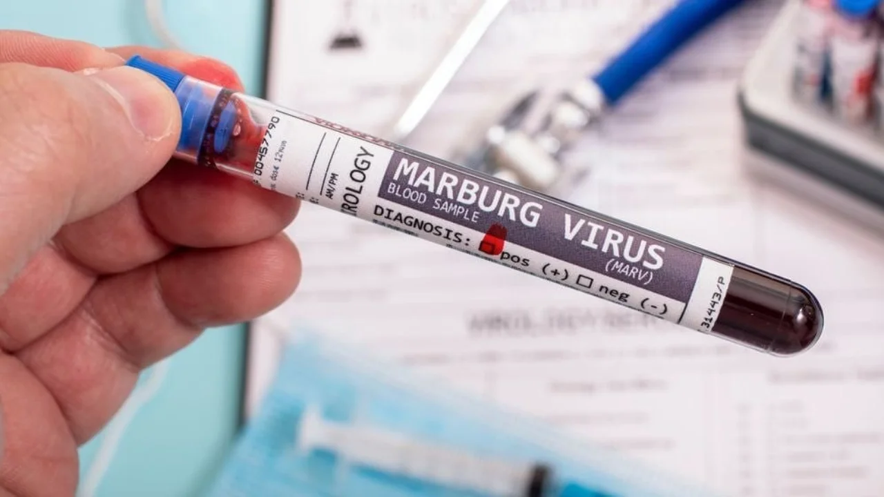 Эфиопияда биринчи марта Марбург вируси аниқланди — хавфли ҳолат тасдиқланди