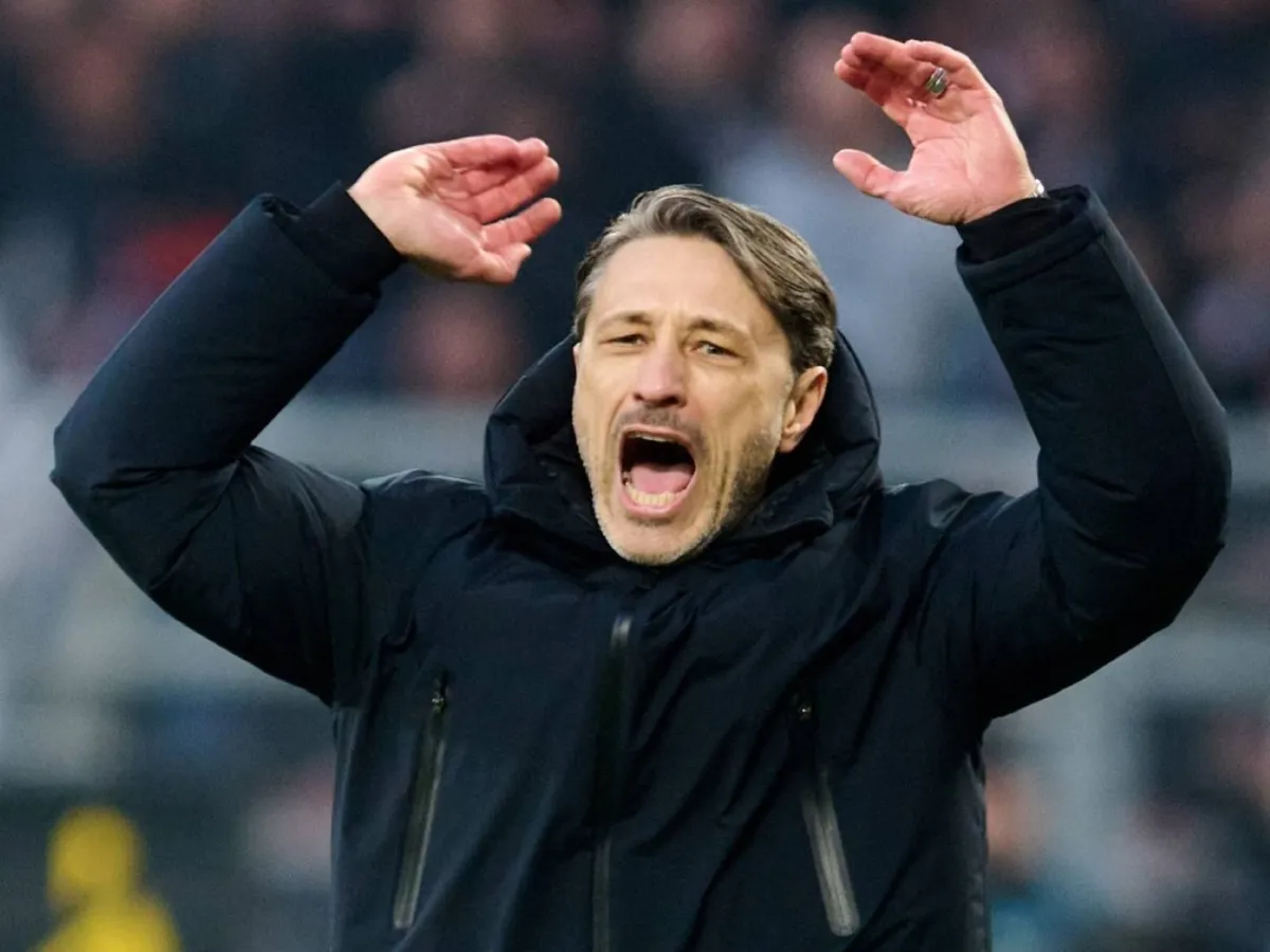 Ковач: "Манчестер Сити"нинг кучини кўрдик