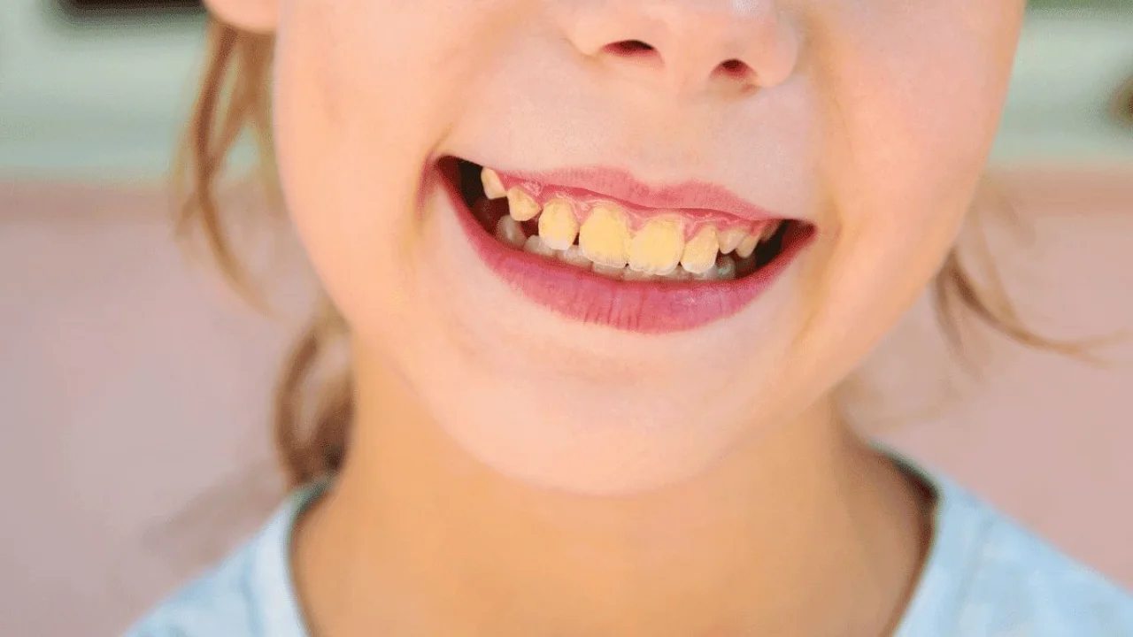 Diş hekimi dişleri sarartan ürünleri listeliyor