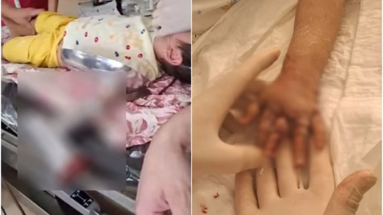 Навоийда 3 ёшли қизалоқнинг қўли қийма майдалагичга кириб кетди