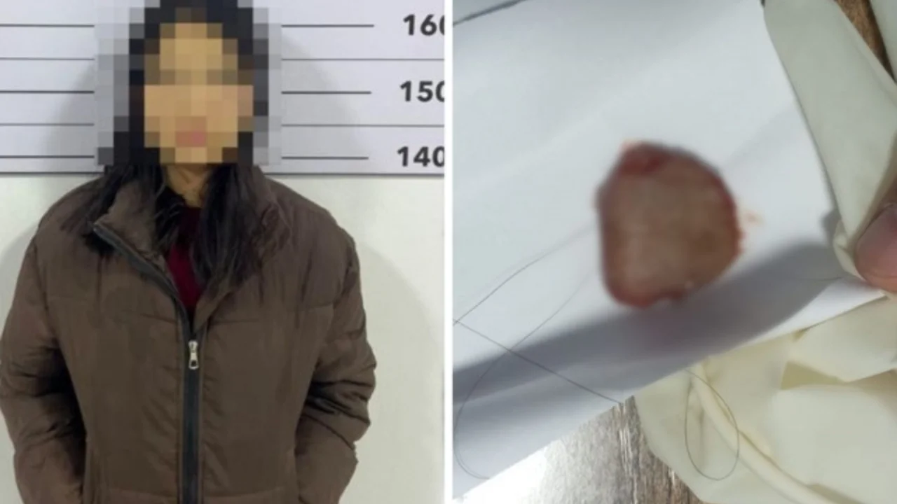 19-летняя девушка откусила язык своему парню