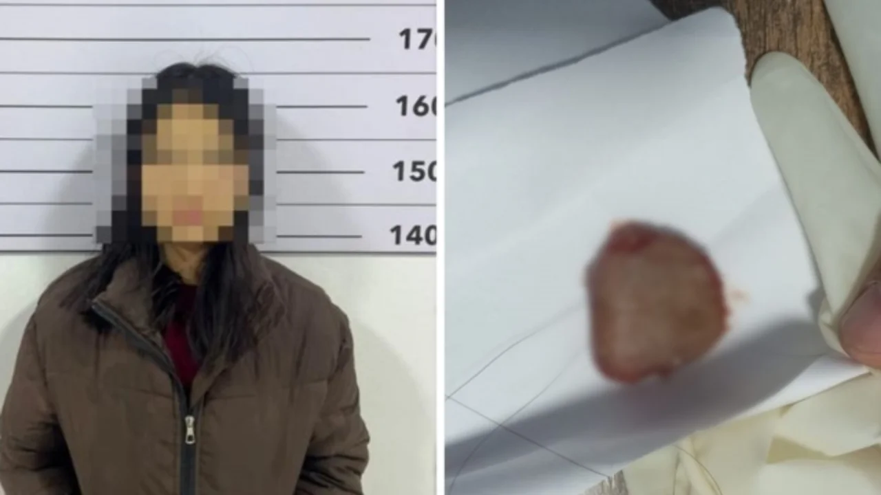 19-летняя девушка в Кыргызстане откусила язык своему возлюбленному