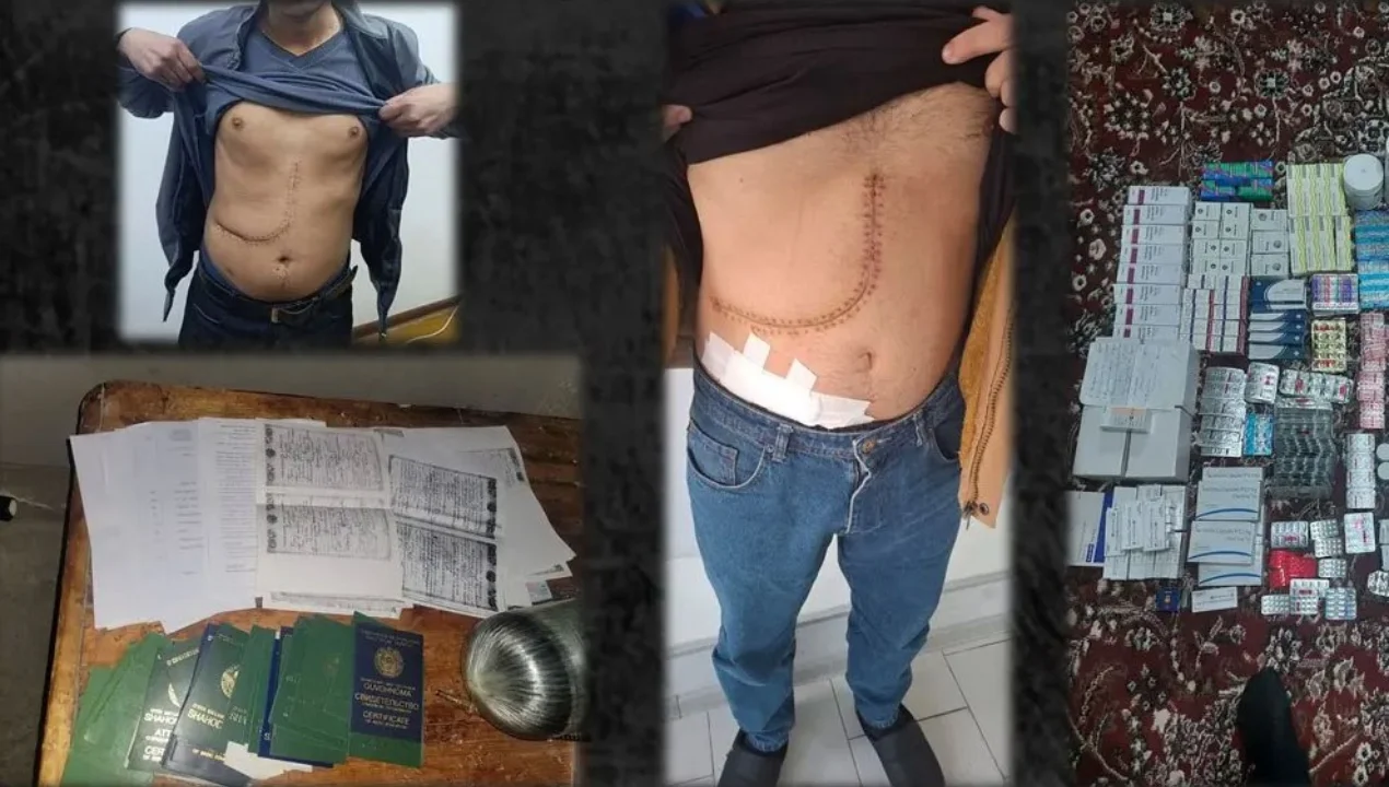 Inson organlari savdosi bilan shug‘ullangan jinoiy guruh a’zolari jazoga tortildi