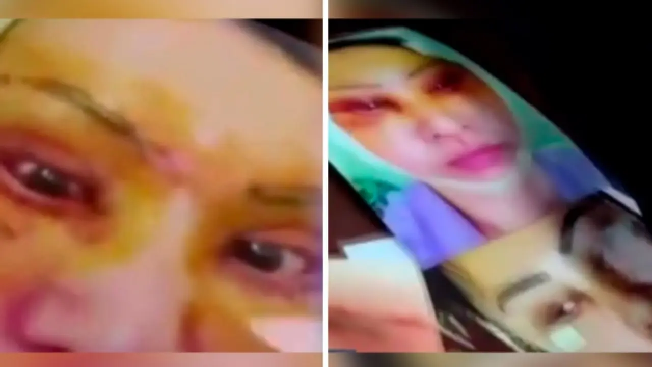 In Tashkent, fake cosmetologist spouses were tried and imprisoned