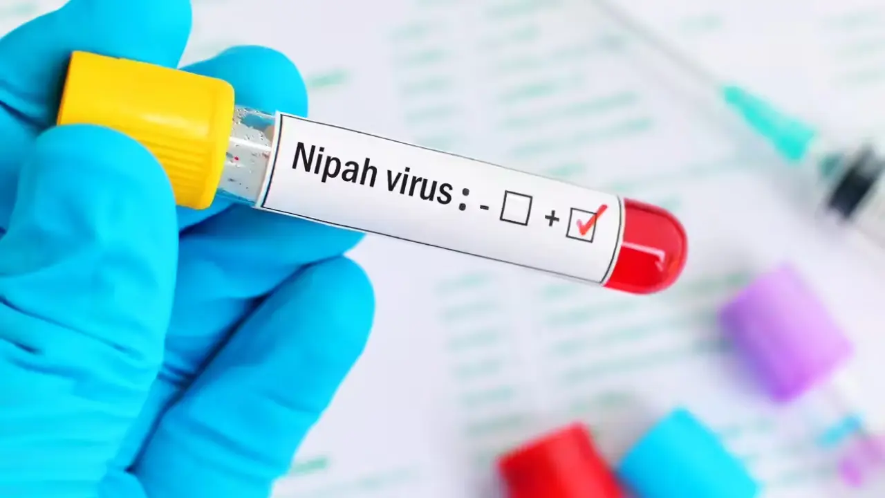 Veterinary restrictions strengthened in Kyrgyzstan due to the threat of Nipah