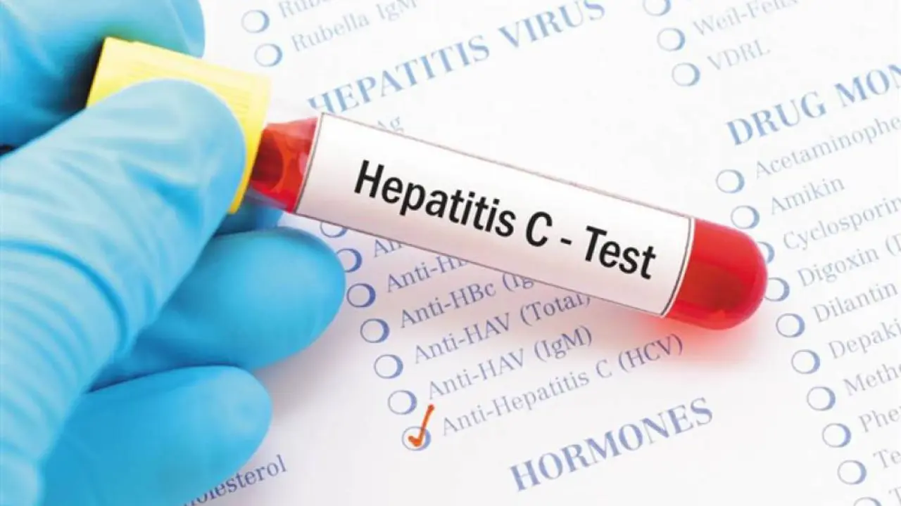 Өзбекстанда "С" гепатитіне қарсы дәрі шығарыла ма?