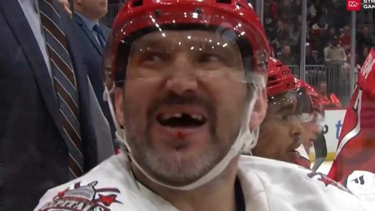 Овечкин лишился зуба в матче с «Чикаго Блэкхокс»