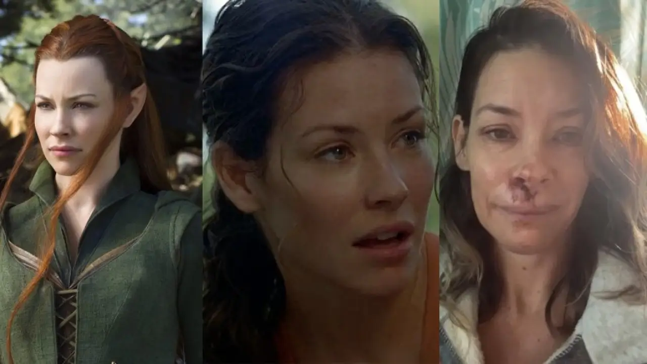 Эванжелин Лилли мия жароҳатидан кейинги асоратларни айтди