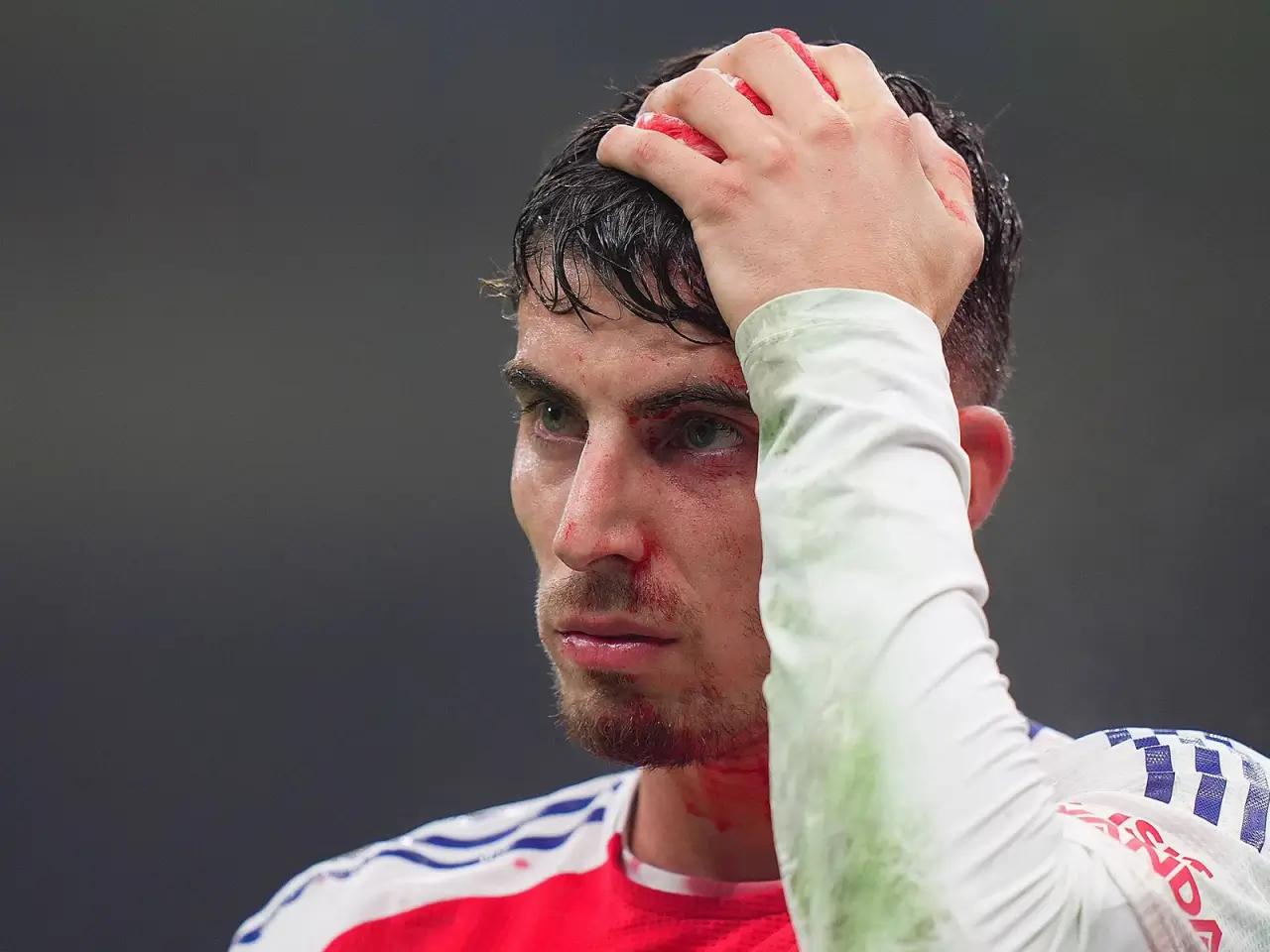 Arteta Havertsning qaytishini jamoa uchun muhim deb atadi