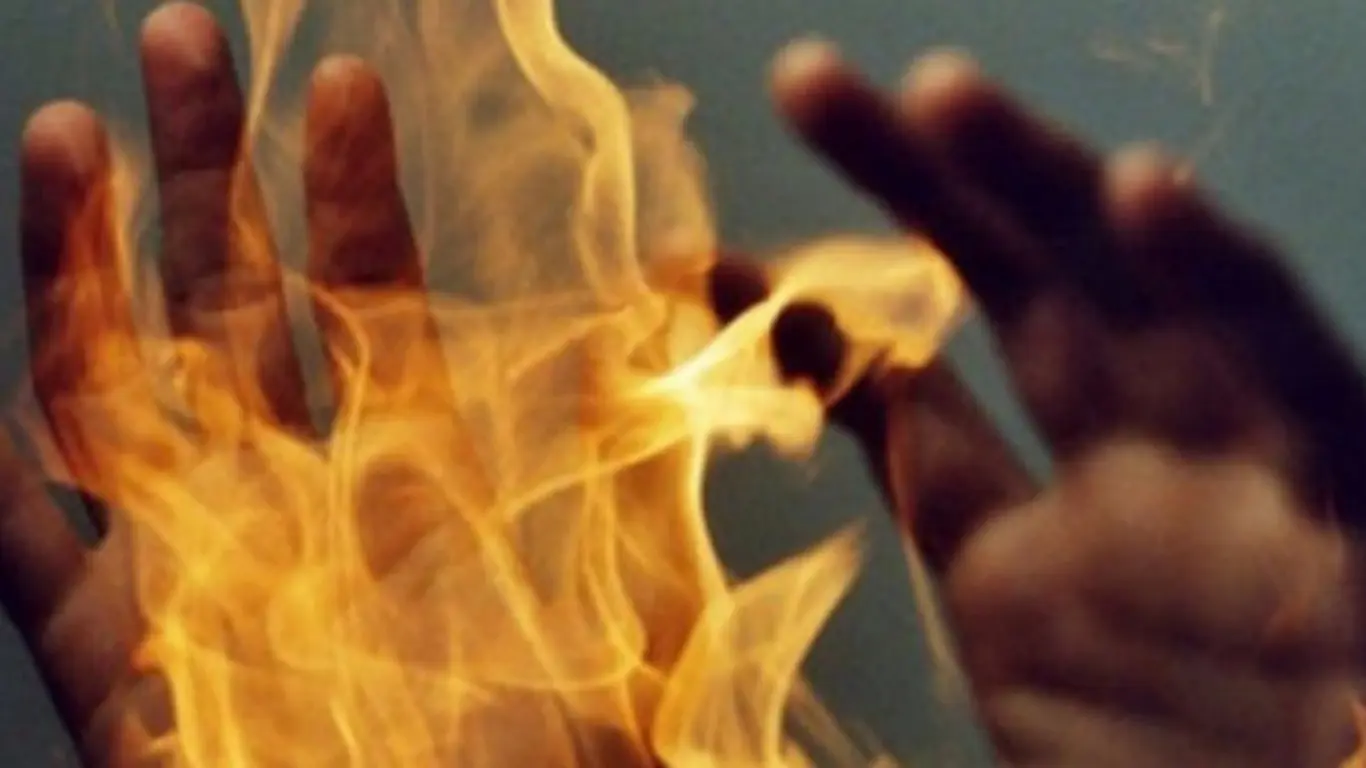 Қизининг ҳомиладорлиги фожиага айланди: она ўзини ёқди