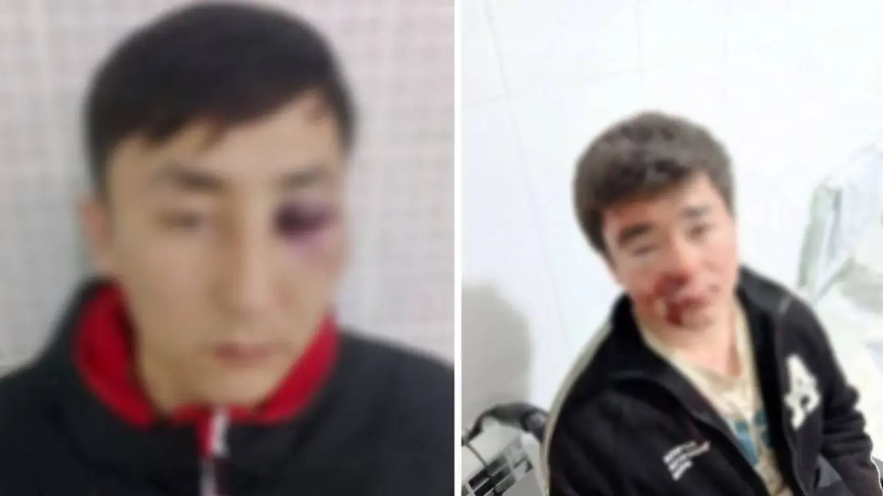 G‘uzorda tungi janjal uch yigitni shifoxonaga olib tushirdi