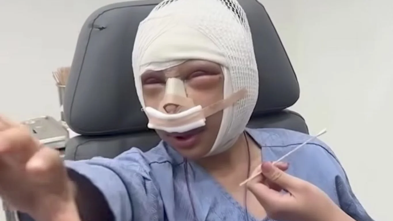 Mujer que se sometió a una cirugía facial por su esposo