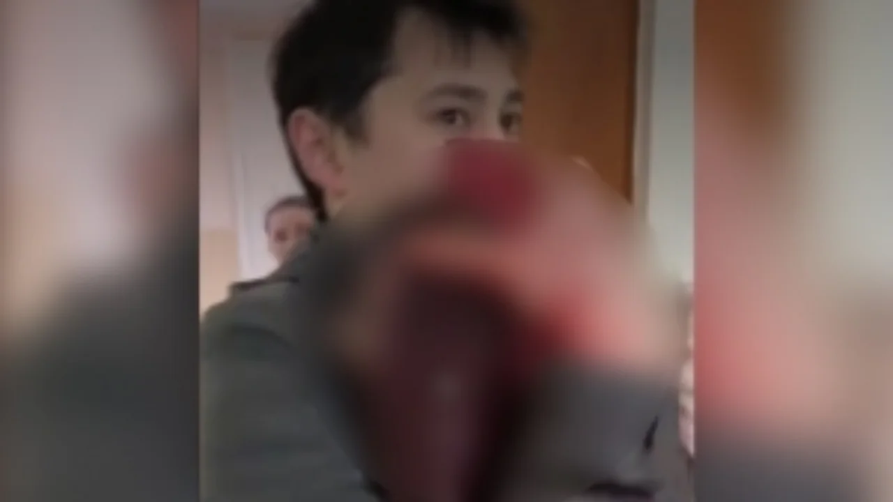 3 yoshli bolaning boshiga g‘isht tushib ketdi