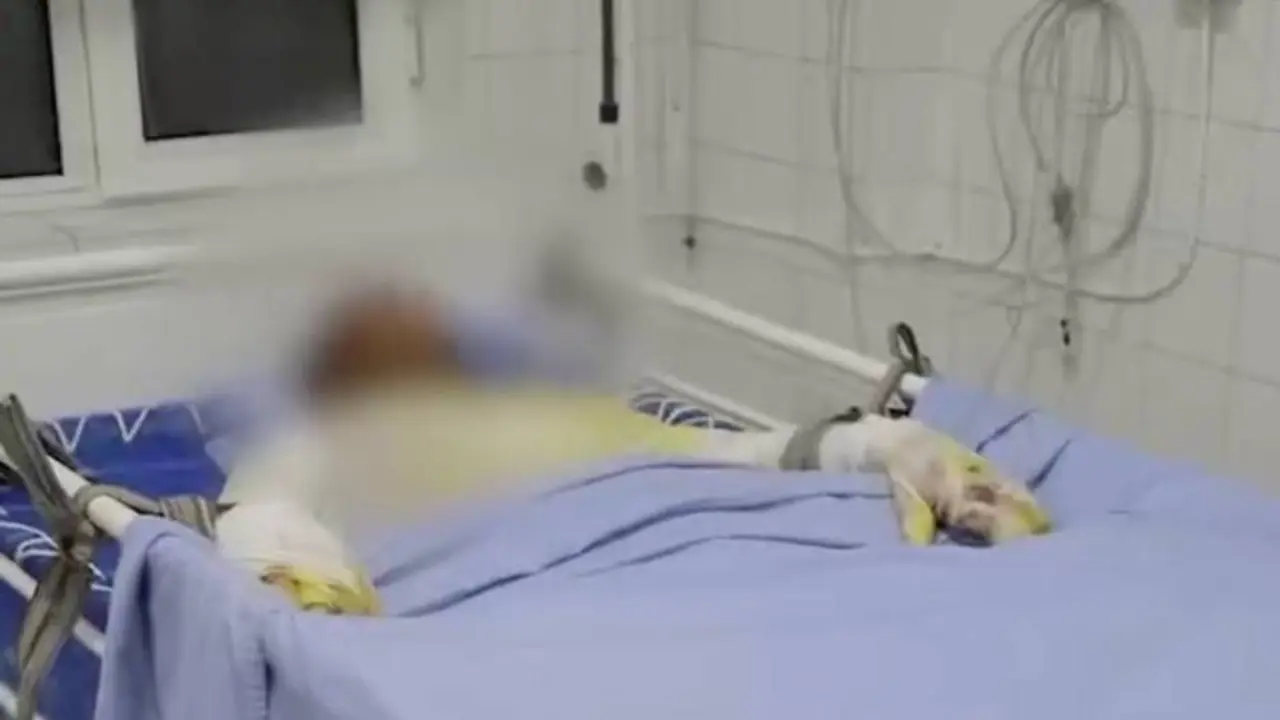 Vagon ustida selfi qilaman deb chiqqan 17 yoshli yigitni tok urdi