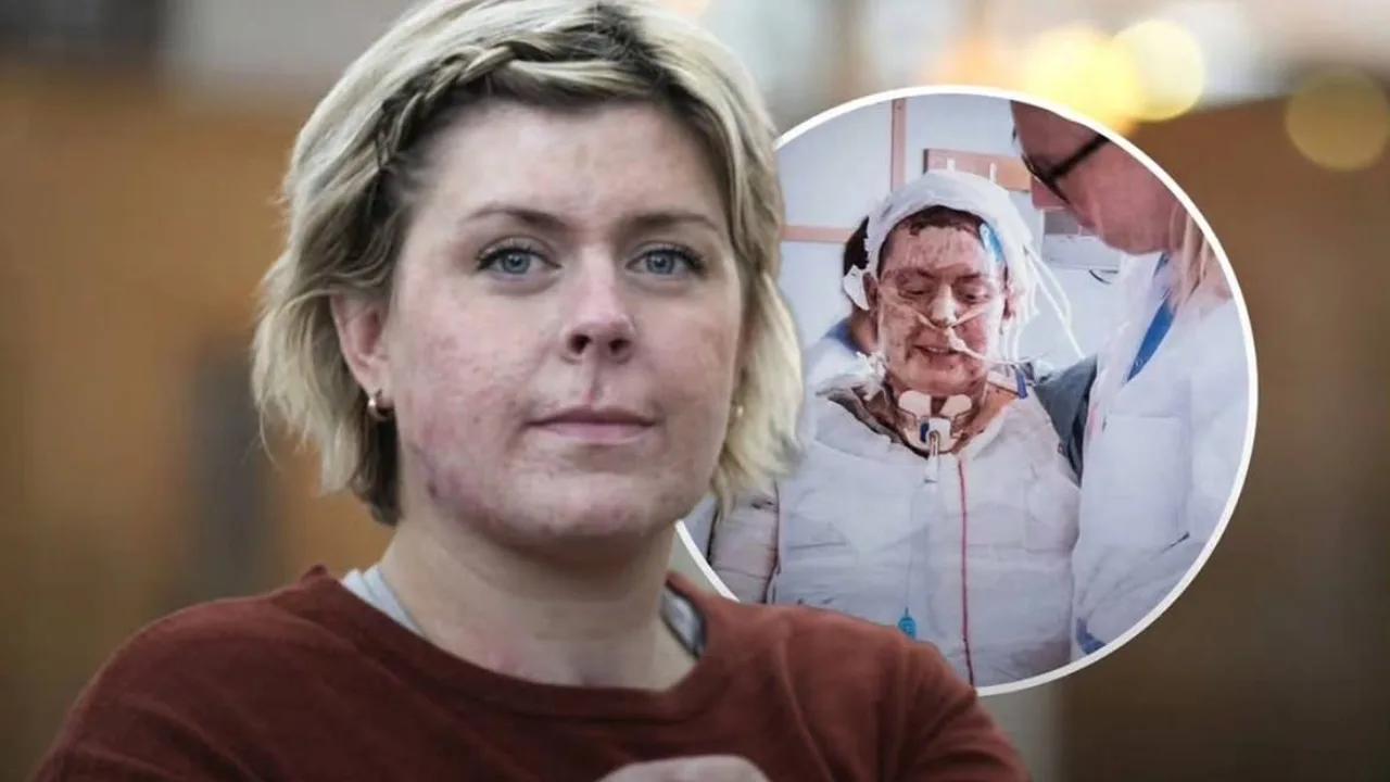 True Heroism: Mother Suffers 93% Burns Saving 6 Children from Burning House