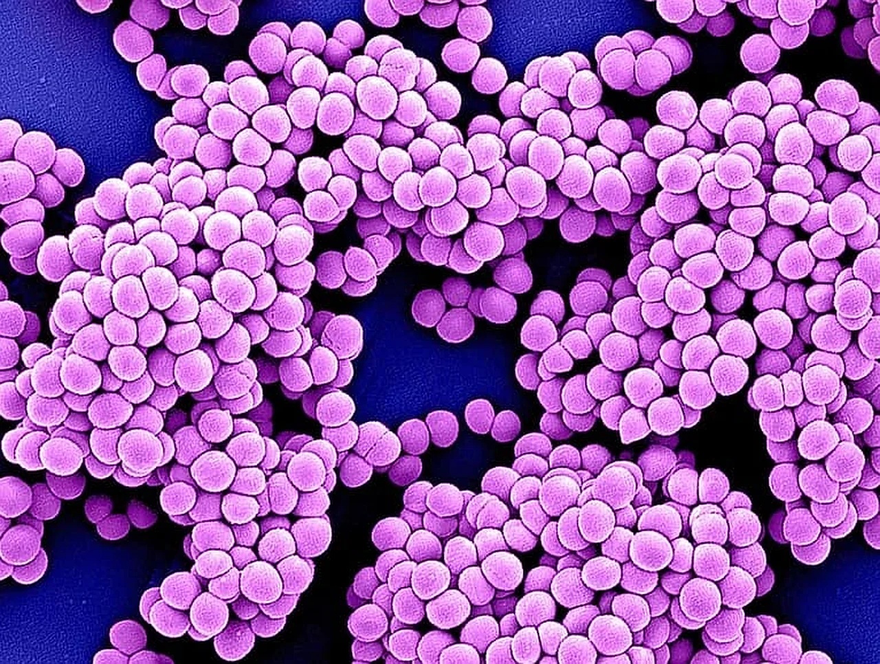 Künstliche Intelligenz entdeckt neue Antibiotika gegen Superbakterien