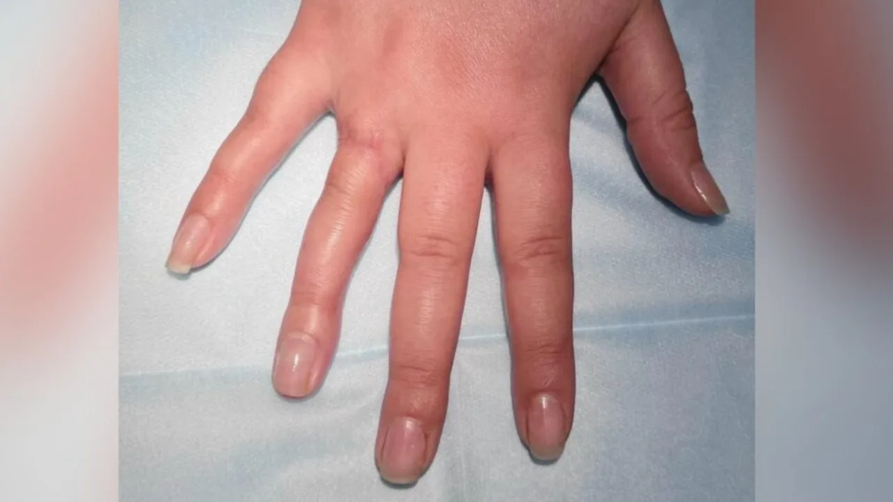 A human hand with swollen fingers against a blue background.