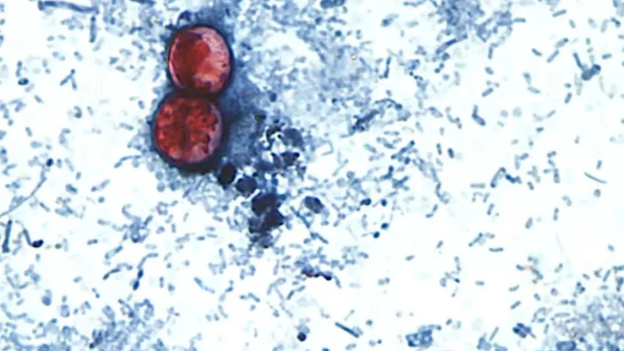 Two dangerous infections spreading in the USA, dozens hospitalized