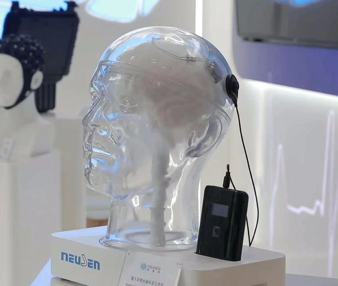 Révolution en neurotechnologie en Chine : premier implant cérébral posé sur un patient