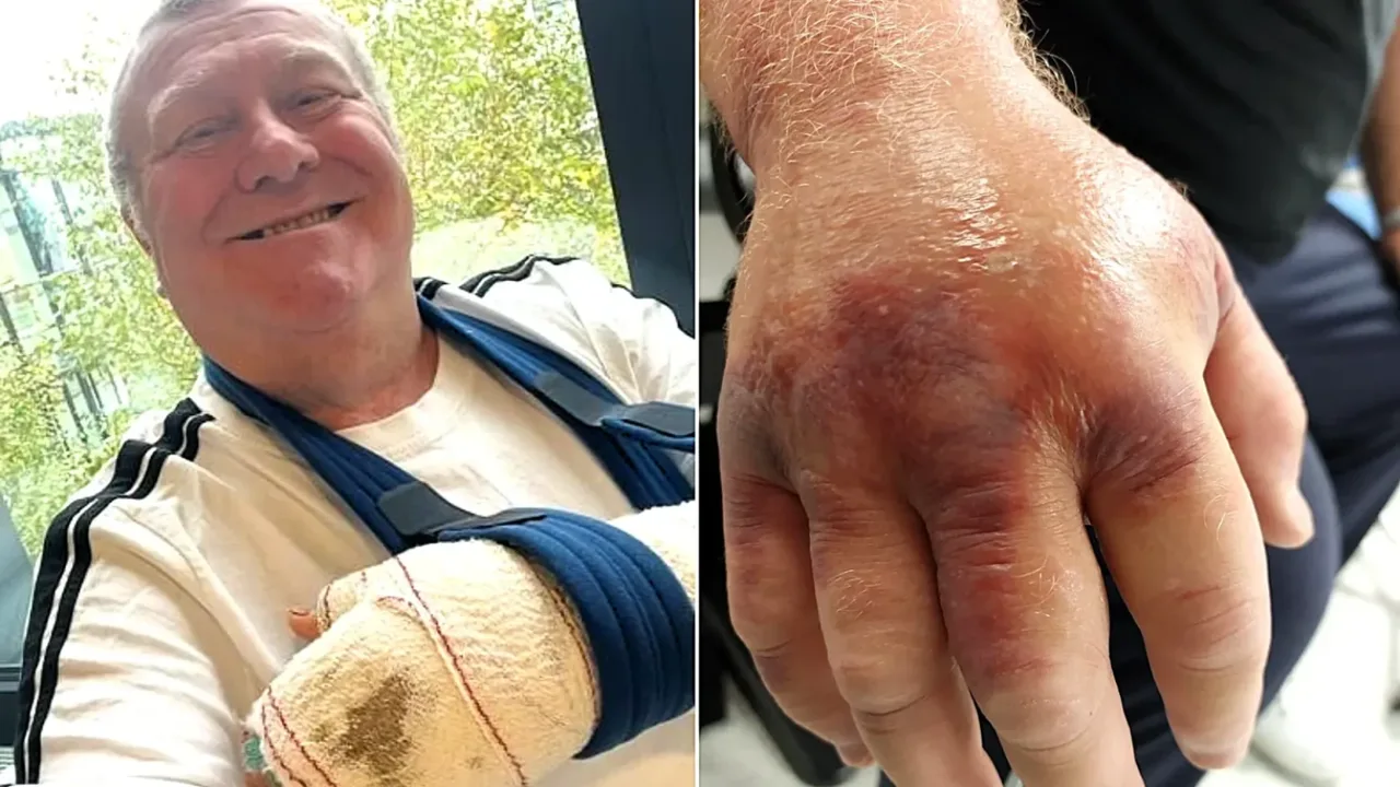 O‘rgimchak chaqishi oqibatida komaga tushgan erkak 42 kg ozdi