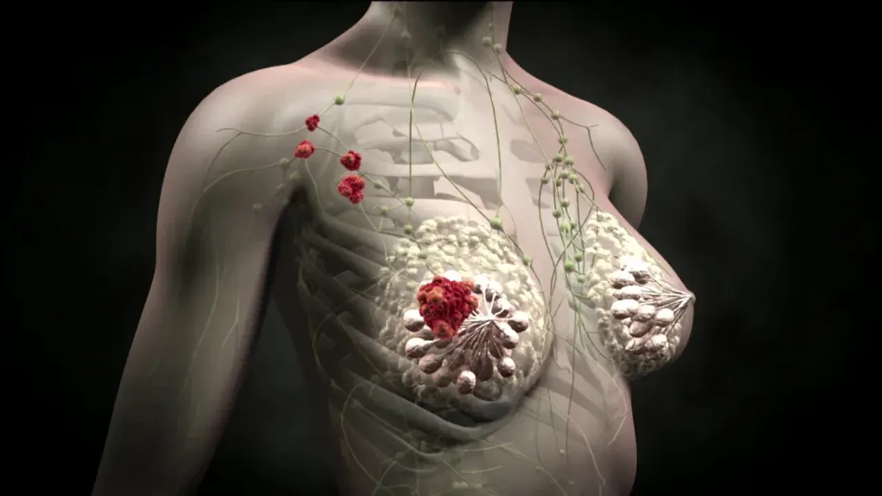 Australian Scientists Identify Molecule That Slows the Progression of Breast Cancer